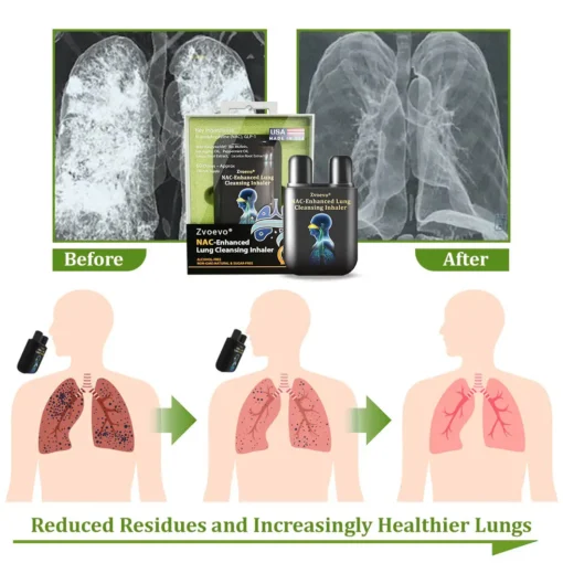 Zvoevo® NAC-Enhanced Lung Cleansing Inhaler