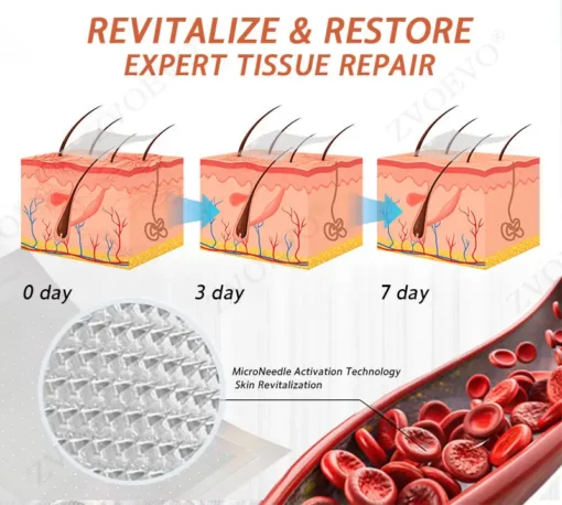 Zvoevo® Vein Ease Microneedle Care Patch