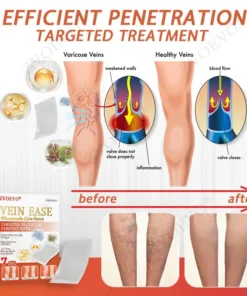 Zvoevo® Vein Ease Microneedle Care Patch