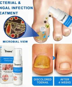 Zvoevo®Magnesium Herbal Psoriasis Spray