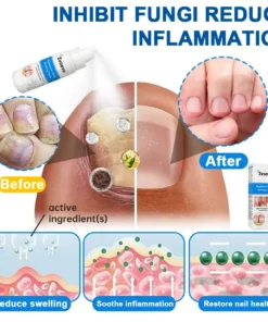 Zvoevo®Magnesium Herbal Psoriasis Spray