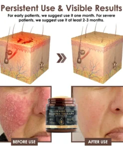 𝐙𝐯𝐨𝐞𝐯𝐨® 𝐓𝐚𝐥𝐥𝐨𝐰 𝐁𝐞𝐞 𝐕𝐞𝐧𝐨𝐦 𝐒𝐤𝐢𝐧 𝐑𝐞𝐬𝐭𝐨𝐫𝐚𝐭𝐢𝐨𝐧 𝐂𝐫𝐞𝐚𝐦
