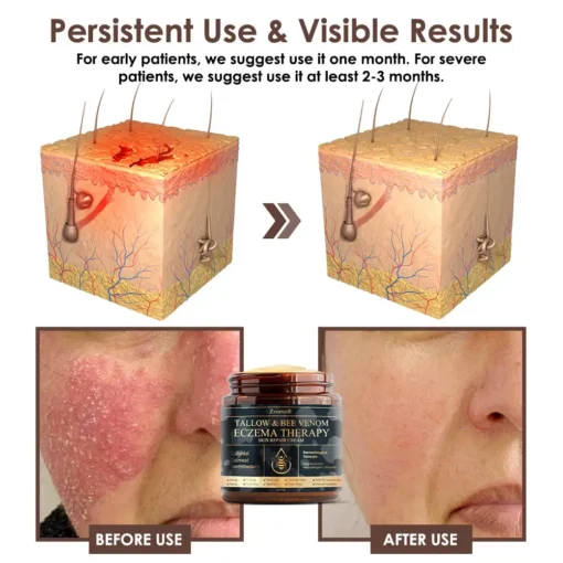 𝐙𝐯𝐨𝐞𝐯𝐨® 𝐓𝐚𝐥𝐥𝐨𝐰 𝐁𝐞𝐞 𝐕𝐞𝐧𝐨𝐦 𝐒𝐤𝐢𝐧 𝐑𝐞𝐬𝐭𝐨𝐫𝐚𝐭𝐢𝐨𝐧 𝐂𝐫𝐞𝐚𝐦