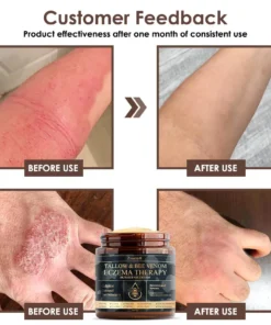 𝐙𝐯𝐨𝐞𝐯𝐨® 𝐓𝐚𝐥𝐥𝐨𝐰 𝐁𝐞𝐞 𝐕𝐞𝐧𝐨𝐦 𝐒𝐤𝐢𝐧 𝐑𝐞𝐬𝐭𝐨𝐫𝐚𝐭𝐢𝐨𝐧 𝐂𝐫𝐞𝐚𝐦