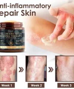 𝐙𝐯𝐨𝐞𝐯𝐨® 𝐓𝐚𝐥𝐥𝐨𝐰 𝐁𝐞𝐞 𝐕𝐞𝐧𝐨𝐦 𝐒𝐤𝐢𝐧 𝐑𝐞𝐬𝐭𝐨𝐫𝐚𝐭𝐢𝐨𝐧 𝐂𝐫𝐞𝐚𝐦