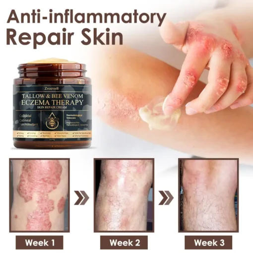 𝐙𝐯𝐨𝐞𝐯𝐨® 𝐓𝐚𝐥𝐥𝐨𝐰 𝐁𝐞𝐞 𝐕𝐞𝐧𝐨𝐦 𝐒𝐤𝐢𝐧 𝐑𝐞𝐬𝐭𝐨𝐫𝐚𝐭𝐢𝐨𝐧 𝐂𝐫𝐞𝐚𝐦