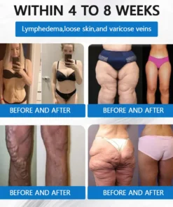 ZVOEVO® SMGT-GLP-1 𝐓𝐢𝐫𝐳𝐞𝐩𝐚𝐭𝐢𝐝𝐞 & 𝐂𝐨𝐥𝐥𝐚𝐠𝐞𝐧 𝐍𝐚𝐧𝐨 𝐌𝐢𝐜𝐫𝐨𝐧𝐞𝐞𝐝𝐥𝐞 𝐖𝐞𝐢𝐠𝐡𝐭 𝐋𝐨𝐬𝐬 𝐏𝐚𝐭𝐜𝐡