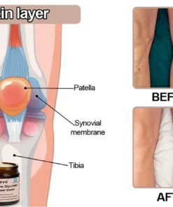 Zvoevo® Magnesium Glycinate Joint Repair Cream
