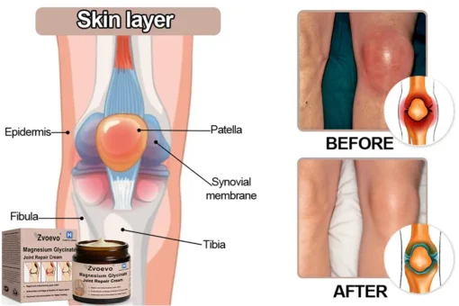 Zvoevo® Magnesium Glycinate Joint Repair Cream