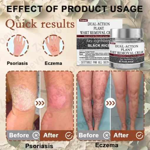 Zvoevo® Rice Bran Essence Cream