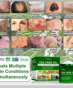 𝐳𝐯𝐨𝐞𝐯𝐨® 𝐓𝐞𝐚 𝐓𝐫𝐞𝐞 𝐎𝐢𝐥 𝐒𝐤𝐢𝐧 𝐓𝐫𝐞𝐚𝐭𝐦𝐞𝐧𝐭 𝐂𝐫𝐞𝐚𝐦