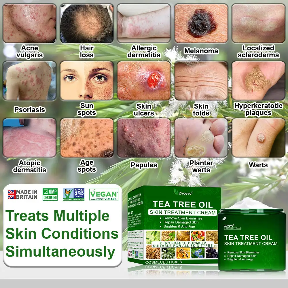 ๐ณ๐ฏ๐จ๐๐ฏ๐จยฎ ๐๐๐ ๐๐ซ๐๐ ๐๐ข๐ฅ ๐๐ค๐ข๐ง ๐๐ซ๐๐๐ญ๐ฆ๐๐ง๐ญ ๐๐ซ๐๐๐ฆ