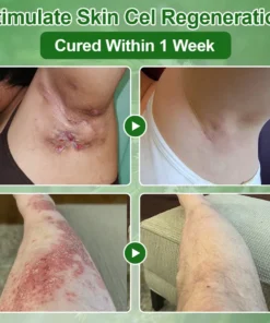 ๐ณ๐ฏ๐จ๐๐ฏ๐จยฎ ๐๐๐ ๐๐ซ๐๐ ๐๐ข๐ฅ ๐๐ค๐ข๐ง ๐๐ซ๐๐๐ญ๐ฆ๐๐ง๐ญ ๐๐ซ๐๐๐ฆ