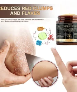 𝐙𝐯𝐨𝐞𝐯𝐨® 𝐌𝐮𝐥𝐭𝐢-𝐒𝐲𝐦𝐩𝐭𝐨𝐦 𝐏𝐬𝐨𝐫𝐢𝐚𝐬𝐢𝐬 & 𝐄𝐜𝐳𝐞𝐦𝐚 𝐓𝐫𝐞𝐚𝐭𝐦𝐞𝐧𝐭 𝐂𝐫𝐞𝐚𝐦