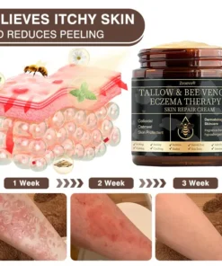 𝐙𝐯𝐨𝐞𝐯𝐨® 𝐌𝐮𝐥𝐭𝐢-𝐒𝐲𝐦𝐩𝐭𝐨𝐦 𝐏𝐬𝐨𝐫𝐢𝐚𝐬𝐢𝐬 & 𝐄𝐜𝐳𝐞𝐦𝐚 𝐓𝐫𝐞𝐚𝐭𝐦𝐞𝐧𝐭 𝐂𝐫𝐞𝐚𝐦