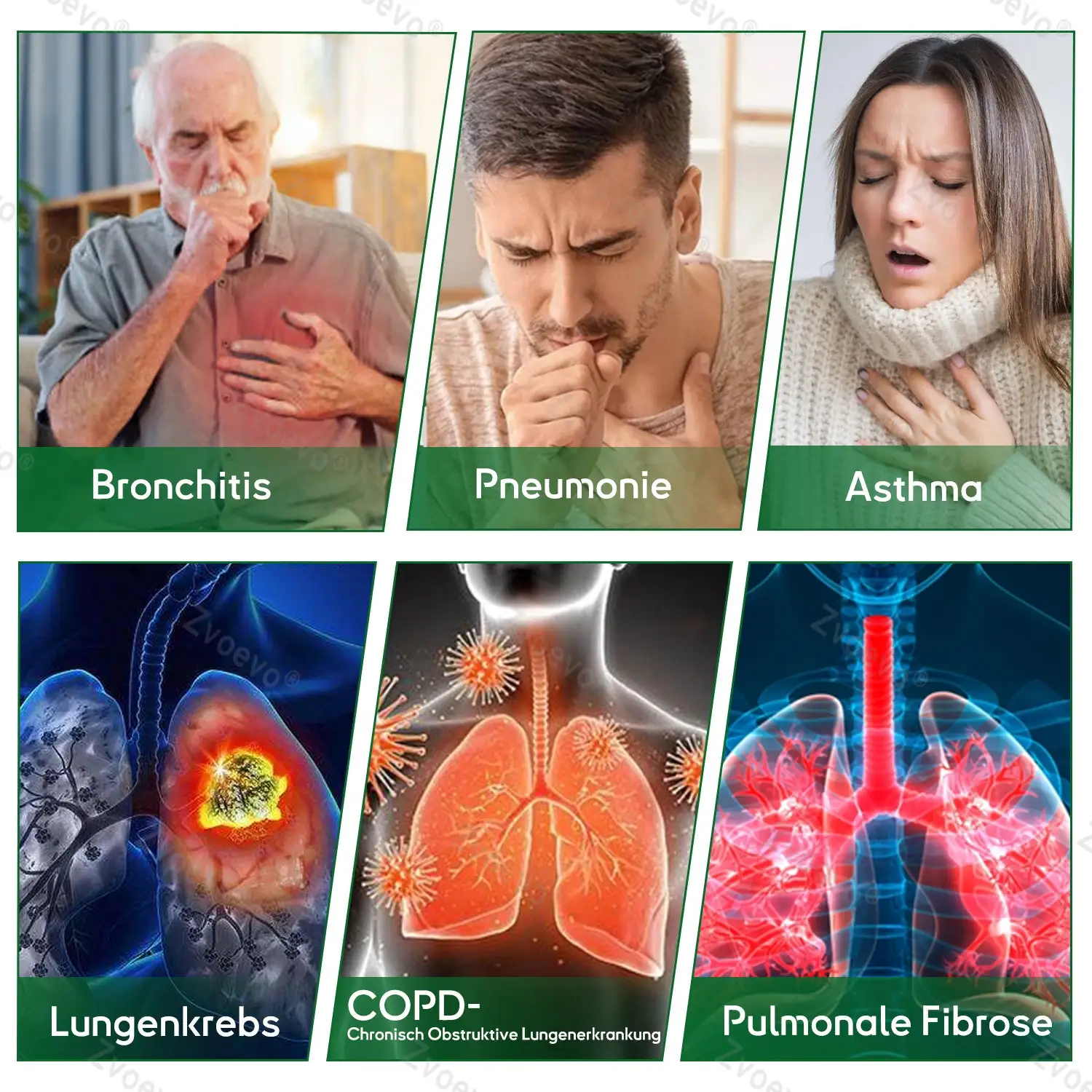 ๐๐ฏ๐จ๐๐ฏ๐จยฎ ๐๐จ๐ฎ๐๐ฅ๐๐๐๐ง๐จ ๐
๐จ๐ซ๐ญ๐ฌ๐๐ก๐ซ๐ข๐ญ๐ญ๐ฅ๐ข๐๐ก๐๐ฌ ๐๐ฎ๐ง๐ ๐๐ง๐๐ง๐ญ๐ ๐ข๐๐ญ๐ฎ๐ง๐ ๐ฌ-๐๐๐ฅ๐๐ฌ๐ญ๐๐ซ ๐ณ๐ฎ๐ซ ๐๐ข๐ง๐๐๐ซ๐ฎ๐ง๐