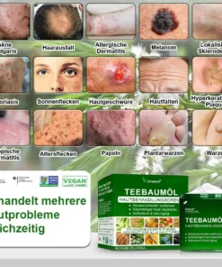 𝐳𝐯𝐨𝐞𝐯𝐨® 𝐓𝐞𝐞𝐛𝐚𝐮𝐦𝐨̈𝐥 𝐇𝐚𝐮𝐭𝐩𝐟𝐥𝐞𝐠𝐞𝐛𝐞𝐡𝐚𝐧𝐝𝐥𝐮𝐧𝐠 𝐂𝐫𝐞𝐦𝐞