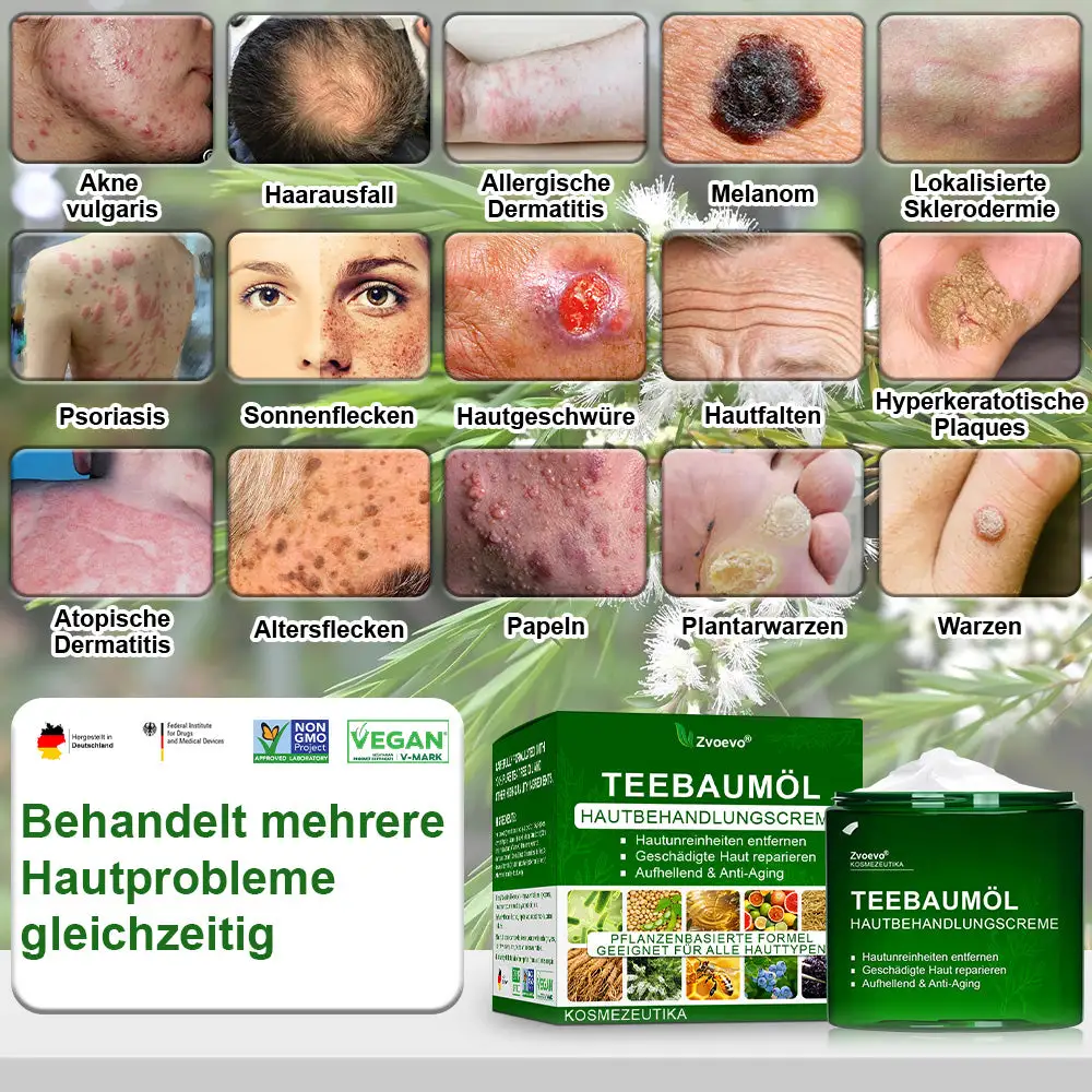 ๐ณ๐ฏ๐จ๐๐ฏ๐จยฎ ๐๐๐๐๐๐ฎ๐ฆ๐จฬ๐ฅ ๐๐๐ฎ๐ญ๐ฉ๐๐ฅ๐๐ ๐๐๐๐ก๐๐ง๐๐ฅ๐ฎ๐ง๐  ๐๐ซ๐๐ฆ๐