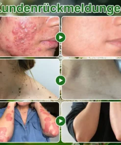 ๐ณ๐ฏ๐จ๐๐ฏ๐จยฎ ๐๐๐๐๐๐ฎ๐ฆ๐จฬ๐ฅ ๐๐๐ฎ๐ญ๐ฉ๐๐ฅ๐๐ ๐๐๐๐ก๐๐ง๐๐ฅ๐ฎ๐ง๐  ๐๐ซ๐๐ฆ๐