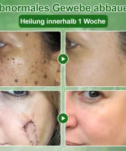 ๐ณ๐ฏ๐จ๐๐ฏ๐จยฎ ๐๐๐๐๐๐ฎ๐ฆ๐จฬ๐ฅ ๐๐๐ฎ๐ญ๐ฉ๐๐ฅ๐๐ ๐๐๐๐ก๐๐ง๐๐ฅ๐ฎ๐ง๐  ๐๐ซ๐๐ฆ๐