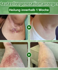 ๐ณ๐ฏ๐จ๐๐ฏ๐จยฎ ๐๐๐๐๐๐ฎ๐ฆ๐จฬ๐ฅ ๐๐๐ฎ๐ญ๐ฉ๐๐ฅ๐๐ ๐๐๐๐ก๐๐ง๐๐ฅ๐ฎ๐ง๐  ๐๐ซ๐๐ฆ๐