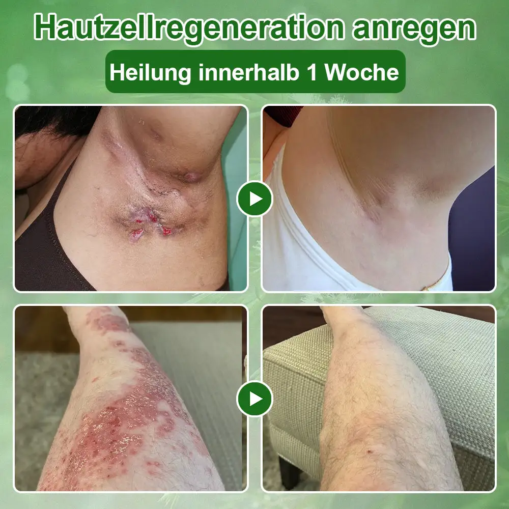 ๐ณ๐ฏ๐จ๐๐ฏ๐จยฎ ๐๐๐๐๐๐ฎ๐ฆ๐จฬ๐ฅ ๐๐๐ฎ๐ญ๐ฉ๐๐ฅ๐๐ ๐๐๐๐ก๐๐ง๐๐ฅ๐ฎ๐ง๐  ๐๐ซ๐๐ฆ๐