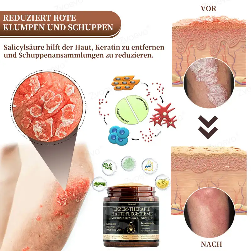 ๐๐ฏ๐จ๐๐ฏ๐จยฎ ๐๐ข๐๐ง๐๐ง๐ ๐ข๐๐ญ ๐๐ฎ๐ฅ๐ญ๐ข๐๐ฎ๐ง๐ค๐ญ๐ข๐จ๐ง๐ฌ-๐๐ก๐๐ซ๐๐ฉ๐ข๐๐๐ซ๐๐ฆ๐