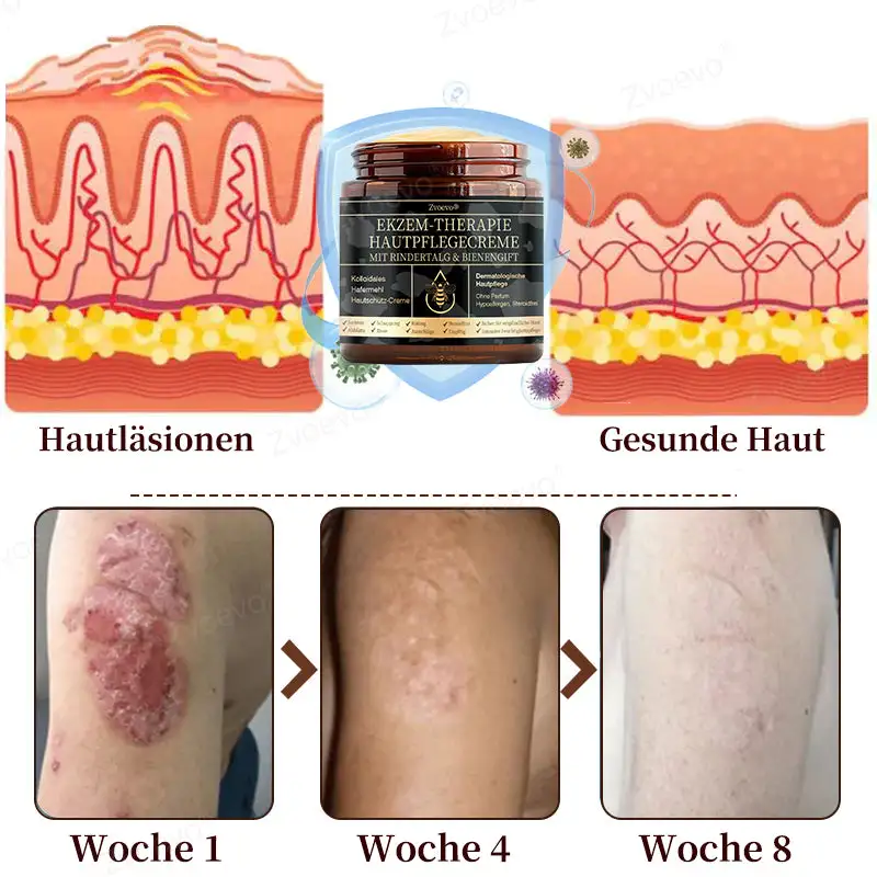 ๐๐ฏ๐จ๐๐ฏ๐จยฎ ๐๐ข๐๐ง๐๐ง๐ ๐ข๐๐ญ ๐๐ฎ๐ฅ๐ญ๐ข๐๐ฎ๐ง๐ค๐ญ๐ข๐จ๐ง๐ฌ-๐๐ก๐๐ซ๐๐ฉ๐ข๐๐๐ซ๐๐ฆ๐