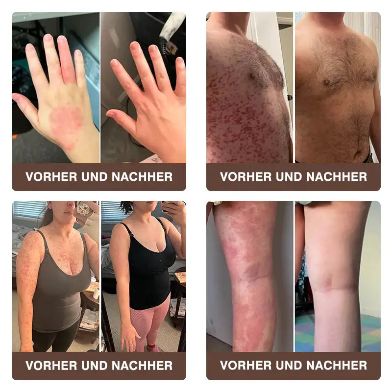 ๐๐ฏ๐จ๐๐ฏ๐จยฎ ๐๐ข๐๐ง๐๐ง๐ ๐ข๐๐ญ ๐๐ฎ๐ฅ๐ญ๐ข๐๐ฎ๐ง๐ค๐ญ๐ข๐จ๐ง๐ฌ-๐๐ก๐๐ซ๐๐ฉ๐ข๐๐๐ซ๐๐ฆ๐