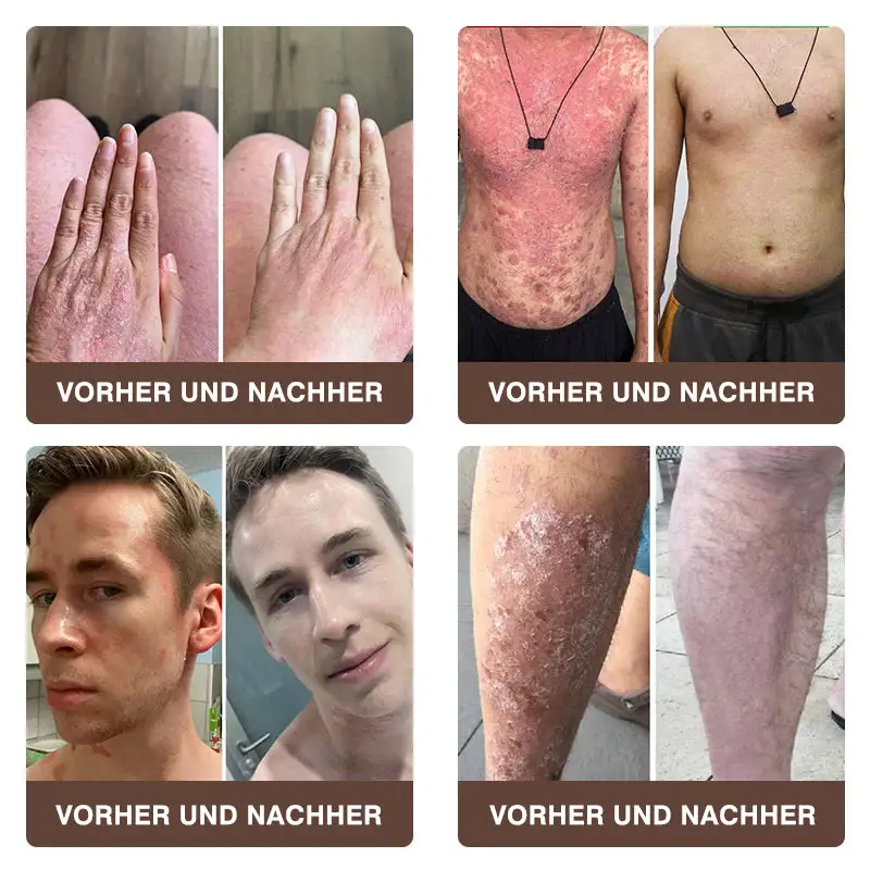 ๐๐ฏ๐จ๐๐ฏ๐จยฎ ๐๐ข๐๐ง๐๐ง๐ ๐ข๐๐ญ ๐๐ฎ๐ฅ๐ญ๐ข๐๐ฎ๐ง๐ค๐ญ๐ข๐จ๐ง๐ฌ-๐๐ก๐๐ซ๐๐ฉ๐ข๐๐๐ซ๐๐ฆ๐