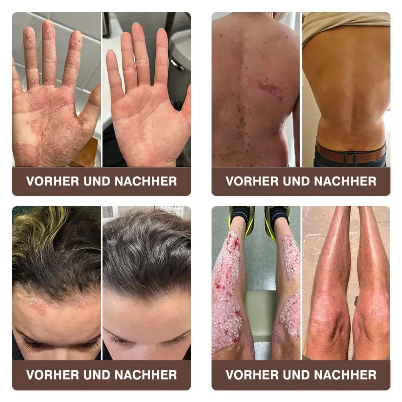 ๐๐ฏ๐จ๐๐ฏ๐จยฎ ๐๐ข๐๐ง๐๐ง๐ ๐ข๐๐ญ ๐๐ฎ๐ฅ๐ญ๐ข๐๐ฎ๐ง๐ค๐ญ๐ข๐จ๐ง๐ฌ-๐๐ก๐๐ซ๐๐ฉ๐ข๐๐๐ซ๐๐ฆ๐