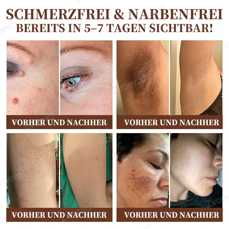 ๐๐ฏ๐จ๐๐ฏ๐จยฎ ๐๐ข๐๐ง๐๐ง๐ ๐ข๐๐ญ ๐๐ฎ๐ฅ๐ญ๐ข๐๐ฎ๐ง๐ค๐ญ๐ข๐จ๐ง๐ฌ-๐๐ก๐๐ซ๐๐ฉ๐ข๐๐๐ซ๐๐ฆ๐