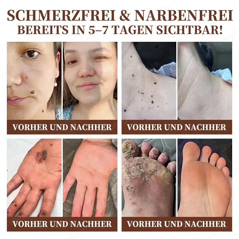 ๐๐ฏ๐จ๐๐ฏ๐จยฎ ๐๐ข๐๐ง๐๐ง๐ ๐ข๐๐ญ ๐๐ฎ๐ฅ๐ญ๐ข๐๐ฎ๐ง๐ค๐ญ๐ข๐จ๐ง๐ฌ-๐๐ก๐๐ซ๐๐ฉ๐ข๐๐๐ซ๐๐ฆ๐