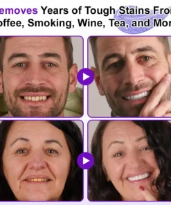 ๐๐ฏ๐จ๐๐ฏ๐จยฎ ๐๐๐ฐ๐-๐๐ซ๐จ๐๐ง๐ญ๐๐ง๐ฌ๐ข๐ฏ๐ ๐๐จ๐จ๐ญ๐ก๐ฉ๐๐ฌ๐ญ๐