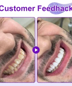 ๐๐ฏ๐จ๐๐ฏ๐จยฎ ๐๐๐ฐ๐-๐๐ซ๐จ๐๐ง๐ญ๐๐ง๐ฌ๐ข๐ฏ๐ ๐๐จ๐จ๐ญ๐ก๐ฉ๐๐ฌ๐ญ๐