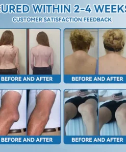 Zvoe๐ฏ๐ผยฎ ๐๐ฏ๐ข-๐๐๐ Joint Healing Cream