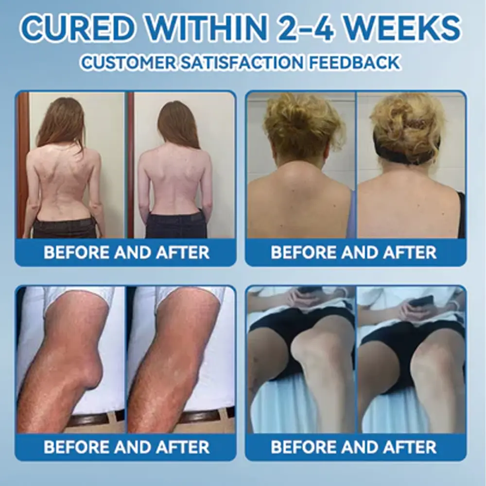 Zvoe๐ฏ๐ผยฎ ๐๐ฏ๐ข-๐๐๐ Joint Healing Cream