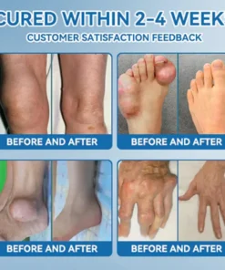 Zvoe๐ฏ๐ผยฎ ๐๐ฏ๐ข-๐๐๐ Joint Healing Cream