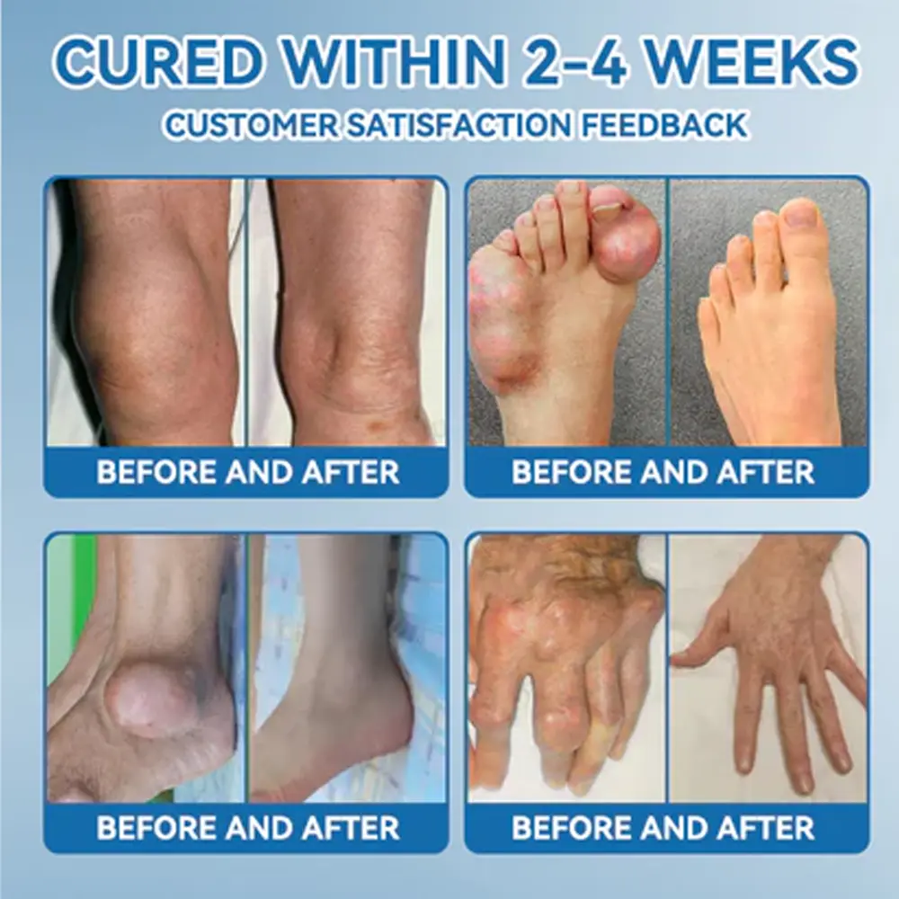 Zvoe๐ฏ๐ผยฎ ๐๐ฏ๐ข-๐๐๐ Joint Healing Cream