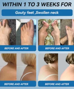 Zvoe𝐯𝗼® 𝗕𝖯𝖢-𝟏𝟓𝟕 Joint Healing Cream