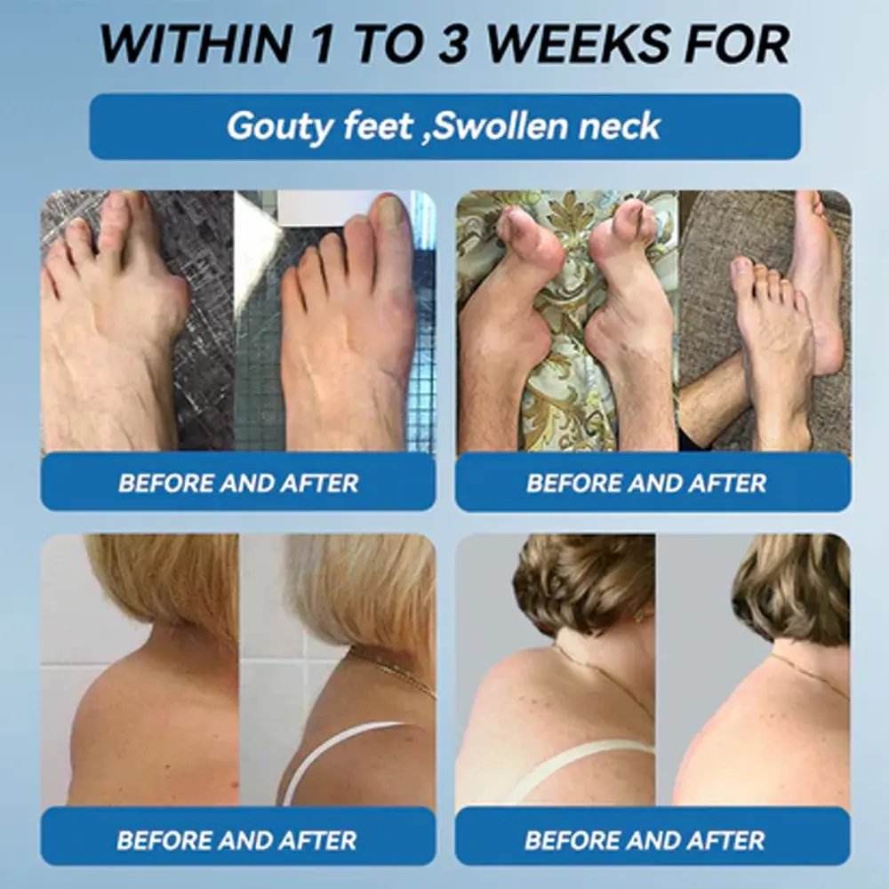 Zvoe๐ฏ๐ผยฎ ๐๐ฏ๐ข-๐๐๐ Joint Healing Cream