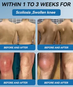 Zvoe๐ฏ๐ผยฎ ๐๐ฏ๐ข-๐๐๐ Joint Healing Cream