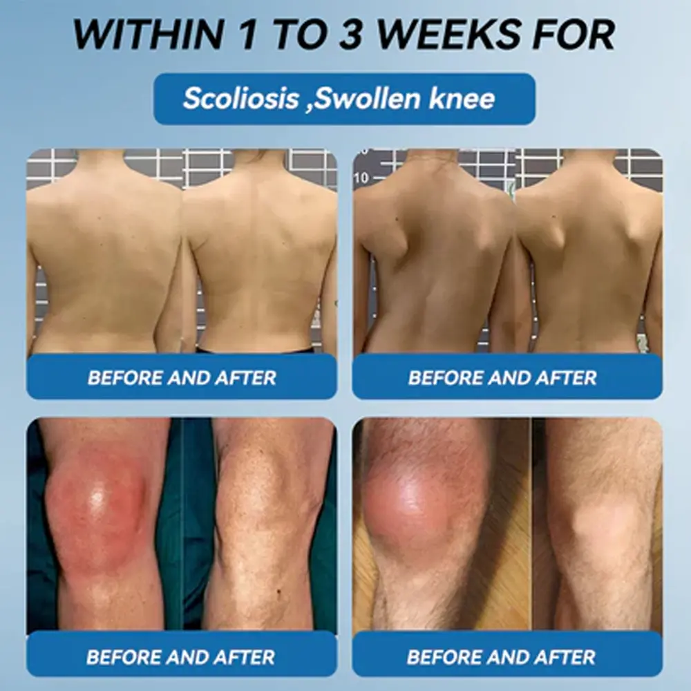 Zvoe๐ฏ๐ผยฎ ๐๐ฏ๐ข-๐๐๐ Joint Healing Cream