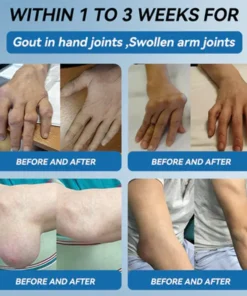 Zvoe๐ฏ๐ผยฎ ๐๐ฏ๐ข-๐๐๐ Joint Healing Cream