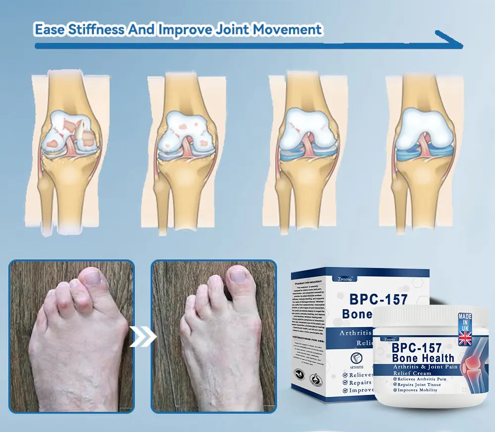 Zvoe๐ฏ๐ผยฎ ๐๐ฏ๐ข-๐๐๐ Joint Healing Cream