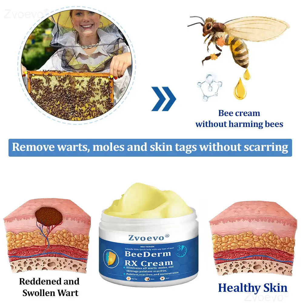 Zvoevo® BeeDerm RX Cream