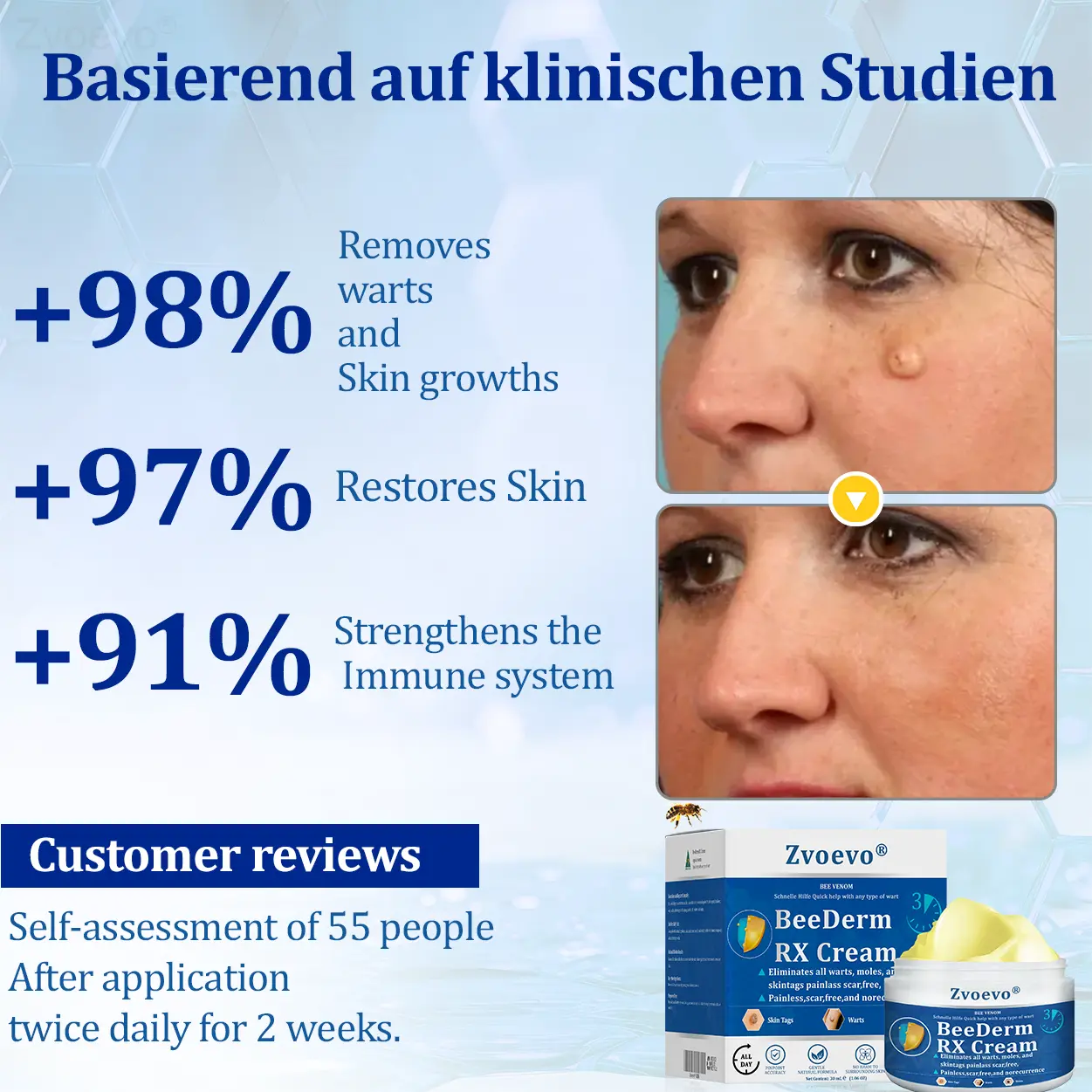 Zvoevo® BeeDerm RX Cream