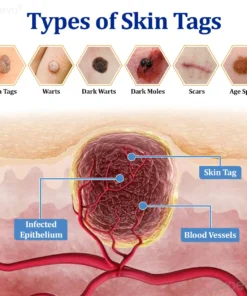 Zvoevo® BeeDerm RX Cream