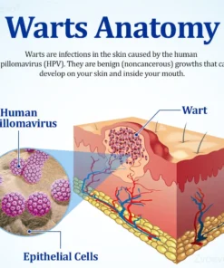 Zvoevo® BeeDerm RX Cream