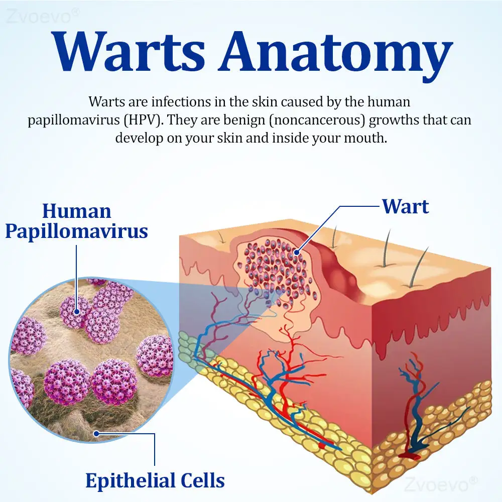 Zvoevo® BeeDerm RX Cream